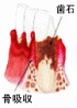 �����a